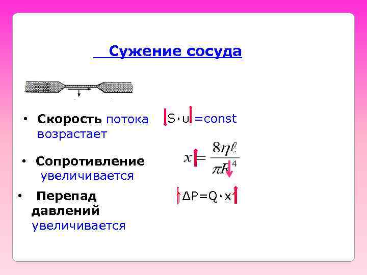  Сужение сосуда • Скорость потока возрастает S٠υ =const • Сопротивление увеличивается • Перепад