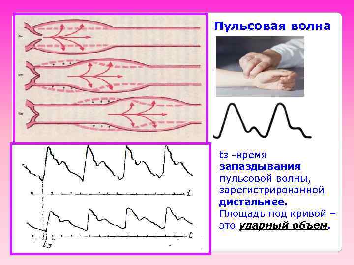 Пульсовая волна tз -время запаздывания пульсовой волны, зарегистрированной дистальнее. Площадь под кривой – это