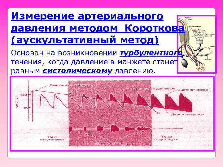 Измерение артериального давления методом Короткова (аускультативный метод) Основан на возникновении турбулентного течения, когда давление