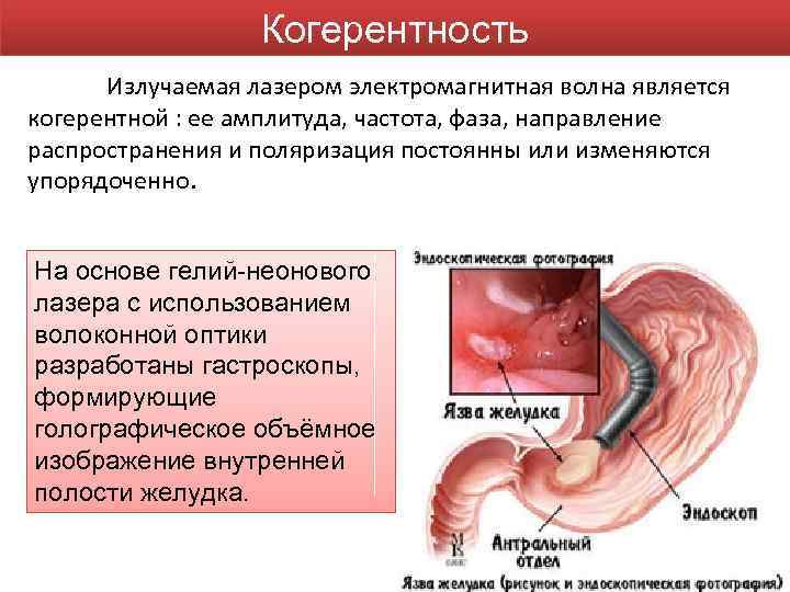 Когерентность Излучаемая лазером электромагнитная волна является когерентной : ее амплитуда, частота, фаза, направление распространения