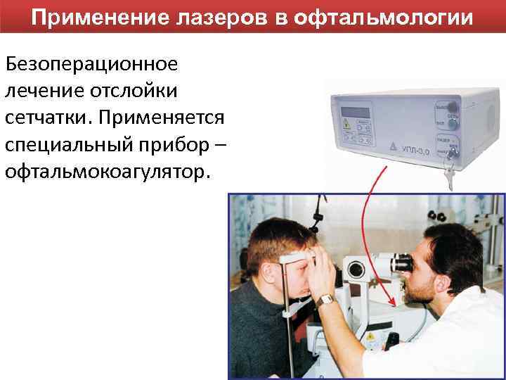 Применение лазеров в офтальмологии Безоперационное лечение отслойки сетчатки. Применяется специальный прибор – офтальмокоагулятор. 