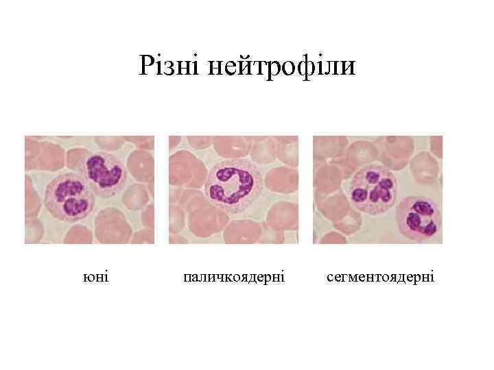 Різні нейтрофіли юні паличкоядерні сегментоядерні 