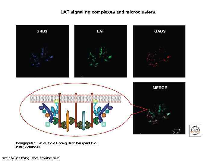 LAT signaling complexes and microclusters. Balagopalan L et al. Cold Spring Harb Perspect Biol