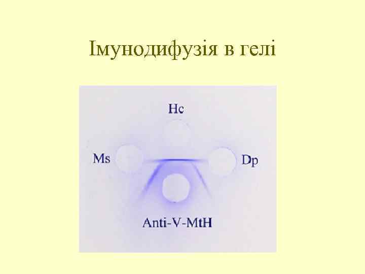 Імунодифузія в гелі 