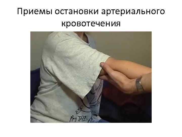 Приемы остановки артериального кровотечения 