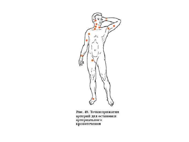 Картинка точки прижатия артерий