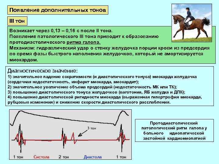 Появление дополнительных тонов III тон Возникает через 0, 13 – 0, 16 с после