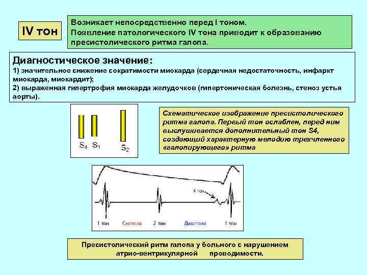 IV тон Возникает непосредственно перед I тоном. Появление патологического IV тона приводит к образованию