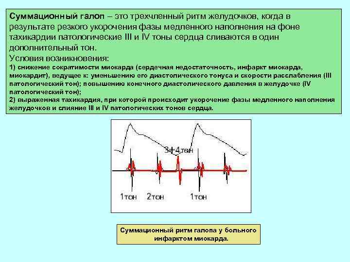 Суммационный галоп – это трехчленный ритм желудочков, когда в результате резкого укорочения фазы медленного