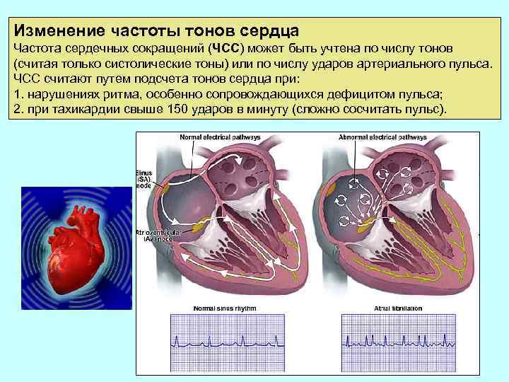 Изменение частоты тонов сердца Частота сердечных сокращений (ЧСС) может быть учтена по числу тонов