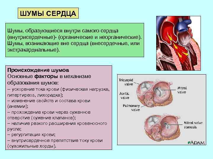 Шумы в сердце. Сердечные шумы. Причины возникновения шумов сердца. Дополнительные шумы сердца. Основные сердечные шумы.