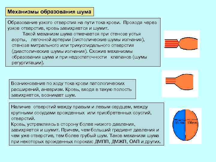 Механизмы образования шума Образование узкого отверстия на пути тока крови. Проходя через узкое отверстие,