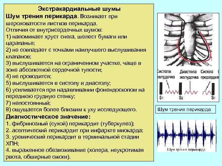  Экстракардиальные шумы Шум трения перикарда. Возникает при шероховатости листков перикарда. Отличия от внутрисердечных