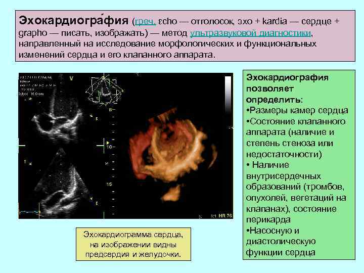 Эхокардиогра фия (греч. εchο — отголосок, эхо + kardia — сердце + graphο —