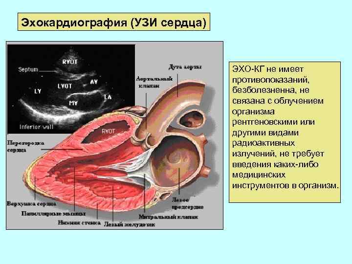 Эхокардиография сердца презентация