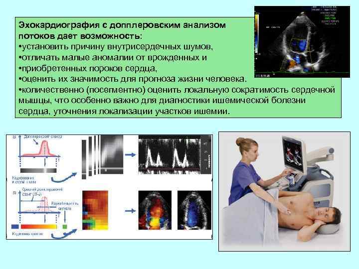 Эхокардиография с допплеровским анализом потоков дает возможность: • установить причину внутрисердечных шумов, • отличать