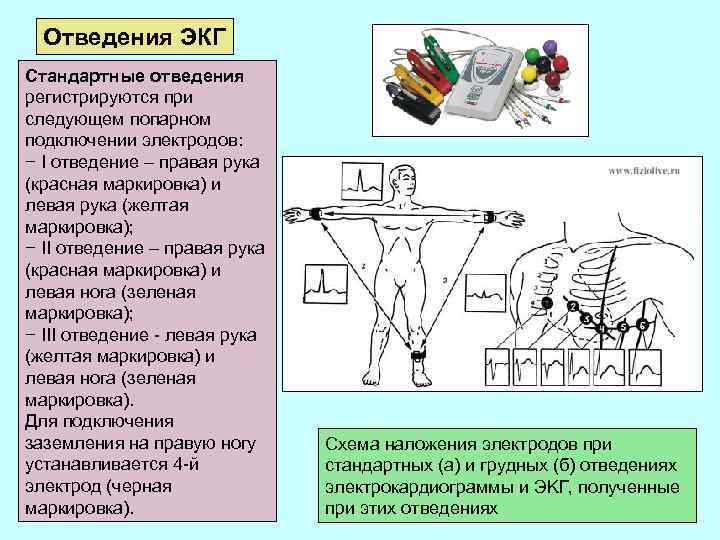 Отведения ЭКГ Стандартные отведения регистрируются при следующем попарном подключении электродов: − I отведение –