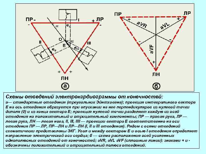 Схемы отведений электрокардиограммы от конечностей: а— стандартные отведения (треугольник Эйнтховена); проекция интегрального вектора Е