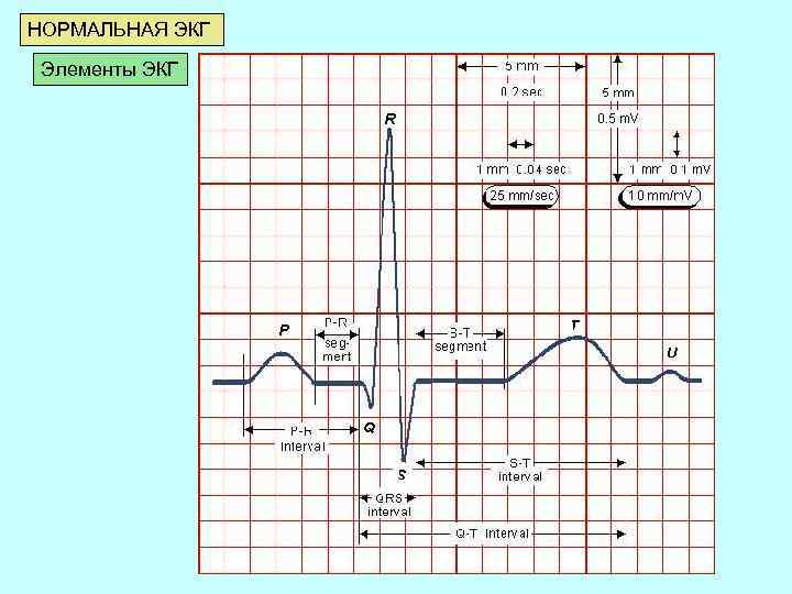 НОРМАЛЬНАЯ ЭКГ Элементы ЭКГ 