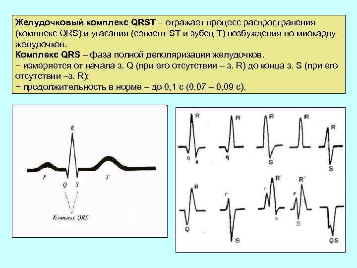 Желудочковый комплекс QRSТ – отражает процесс распространения (комплекс QRS) и угасания (сегмент ST и