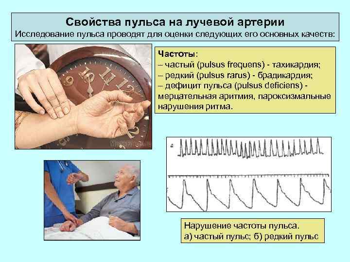 При измерении пульса человека 75. Проведение исследования пульса алгоритм. Характеристика пульса на лучевой артерии. Исследование пульса на лучевой артерии алгоритм. Измерение пульса характеристика.