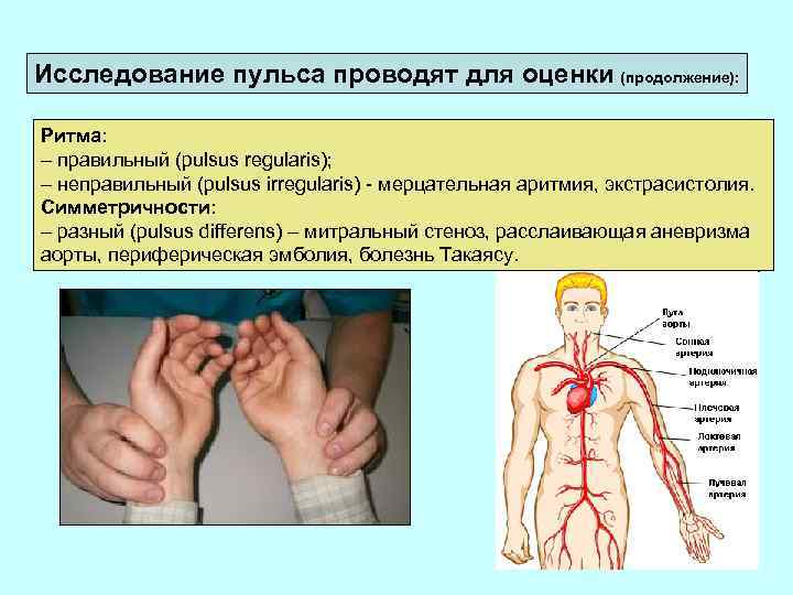 Исследование пульса проводят для оценки (продолжение): Ритма: – правильный (pulsus regularis); – неправильный (pulsus