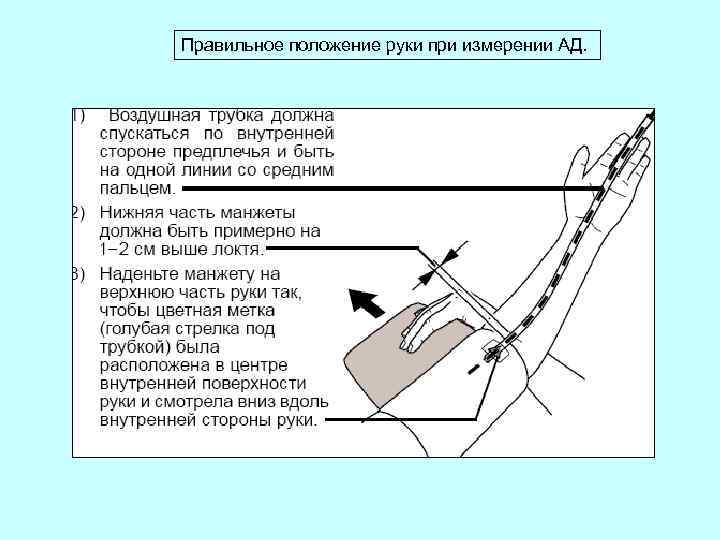 Правильное положение руки при измерении АД. 