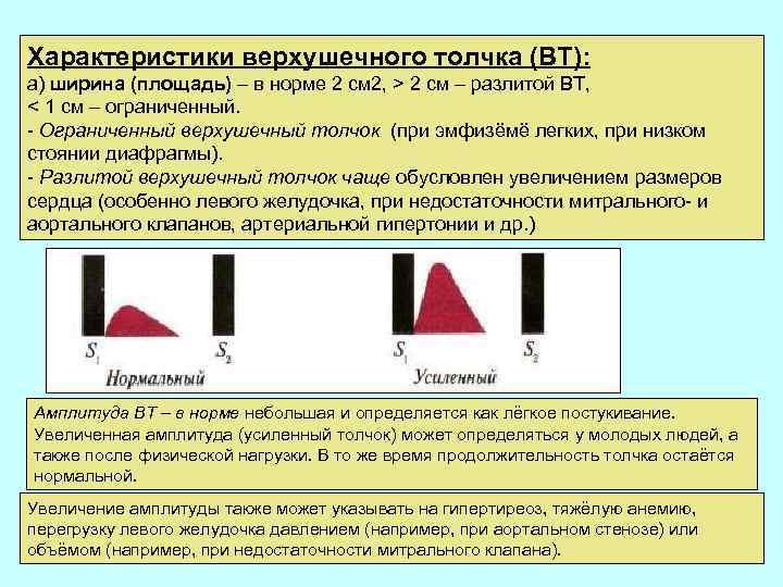 Характеристики верхушечного толчка (ВТ): а) ширина (площадь) – в норме 2 см 2, >