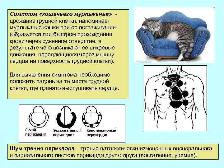 Симптом «кошачьего мурлыканья» дрожание грудной клетки, напоминает мурлыкание кошки при ее поглаживании (образуется при