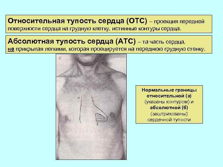 Относительная тупость сердца (ОТС) – проекция передней поверхности сердца на грудную клетку, истинные контуры