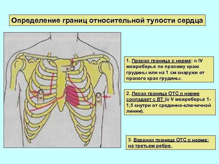 Верхняя граница относительной. Норма левой границы относительной тупости сердца. Методика определения границ абсолютной тупости сердца.