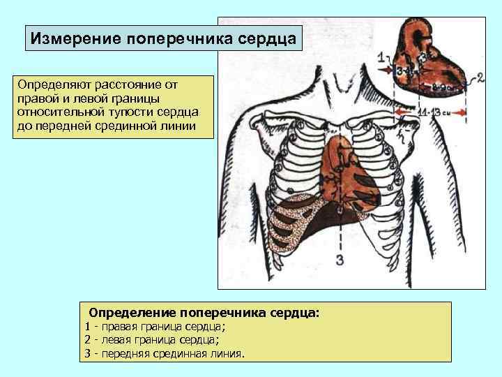 Измерение поперечника сердца Определяют расстояние от правой и левой границы относительной тупости сердца до