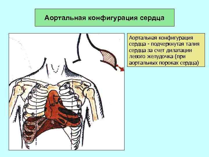 Нормальная конфигурация сердца рисунок