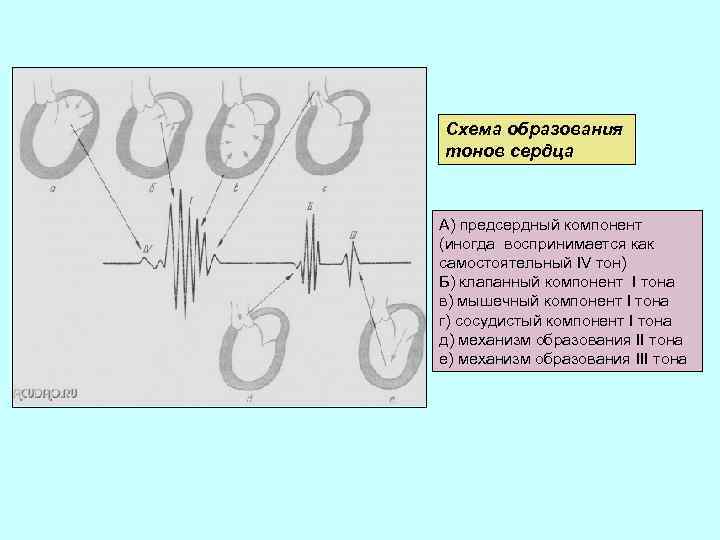 Схема образования тонов сердца А) предсердный компонент (иногда воспринимается как самостоятельный IV тон) Б)