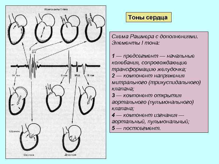 Тоны сердца Схема Рашмера с дополнениями. Элементы I тона: 1 — предсегмент — начальные