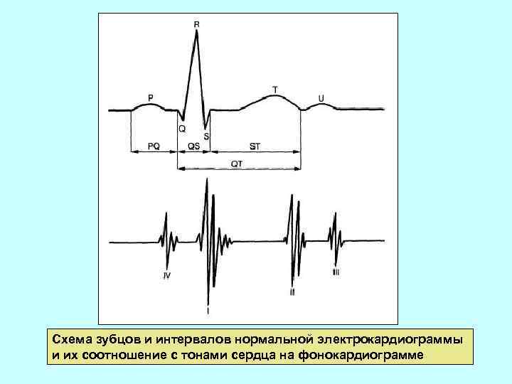 Схема зубцов и интервалов нормальной электрокардиограммы и их соотношение с тонами сердца на фонокардиограмме