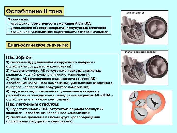 Ослабление II тона Механизмы: – нарушение герметичности смыкания АК и КЛА; – уменьшение скорости