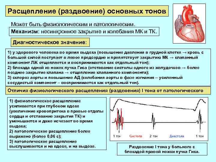 Склероз аорты сердца что. Изменения второго тона сердца. Методы изучения органного кровотока. Физиологическое изменение тонов сердца. Диагностическое значение тонов сердца.