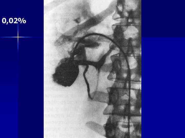 0, 02% 