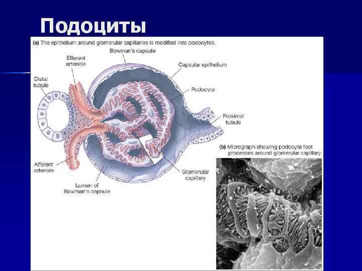 Подоциты 