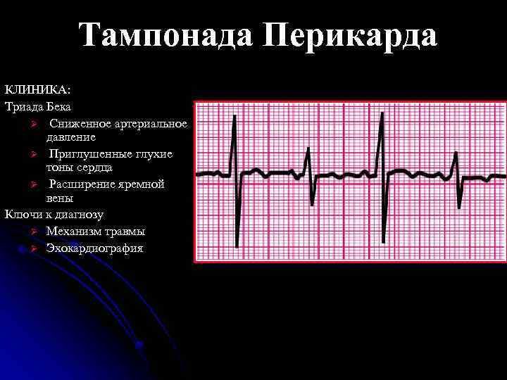 Триада бека