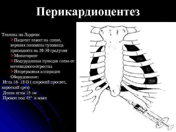 Верхняя половина туловища