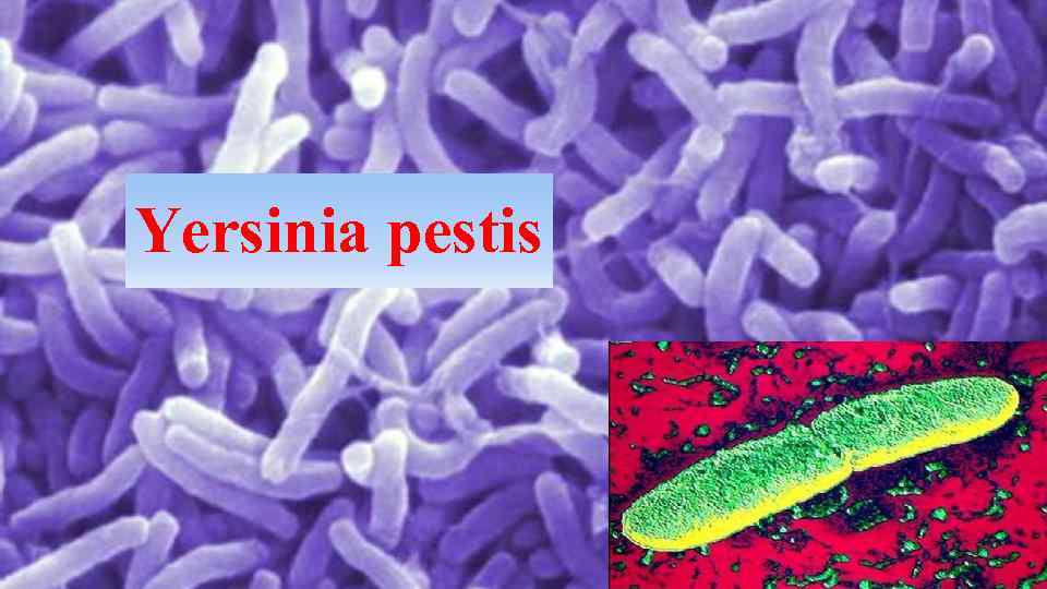 Yersinia pestis 