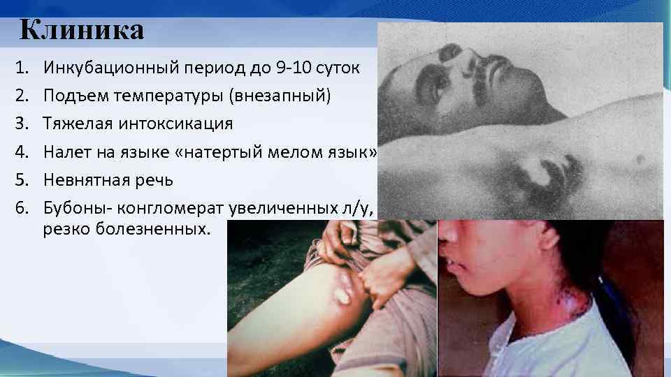 Клиника 1. 2. 3. 4. 5. 6. Инкубационный период до 9 -10 суток Подъем