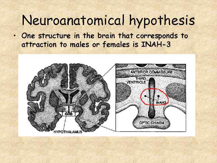 Neuroanatomical hypothesis • One structure in the brain that corresponds to attraction to males