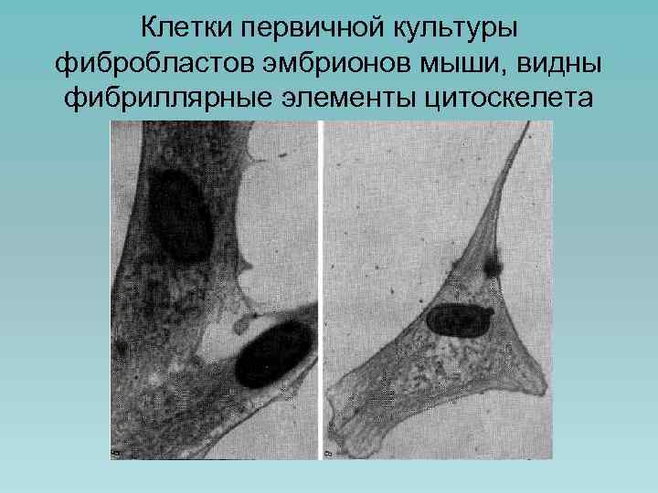 Клетки первичной культуры фибробластов эмбрионов мыши, видны фибриллярные элементы цитоскелета 