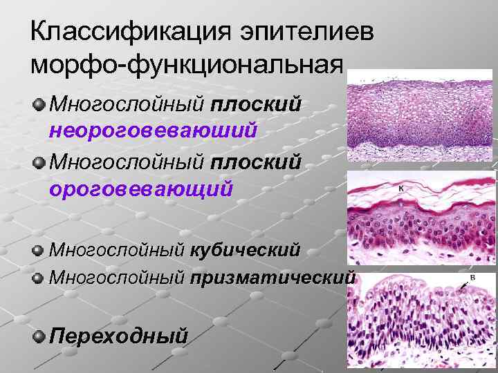 В эпителиях присутствуют. Классификация многослойного эпителия. Эпителиальная ткань ороговевающий. Многослойный ороговевающий эпителий строение. Многослойный переходный эпителий.