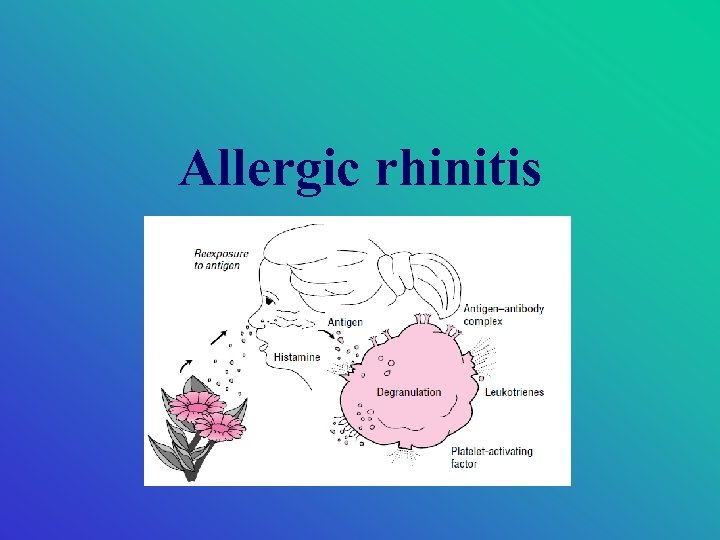 Allergic rhinitis 