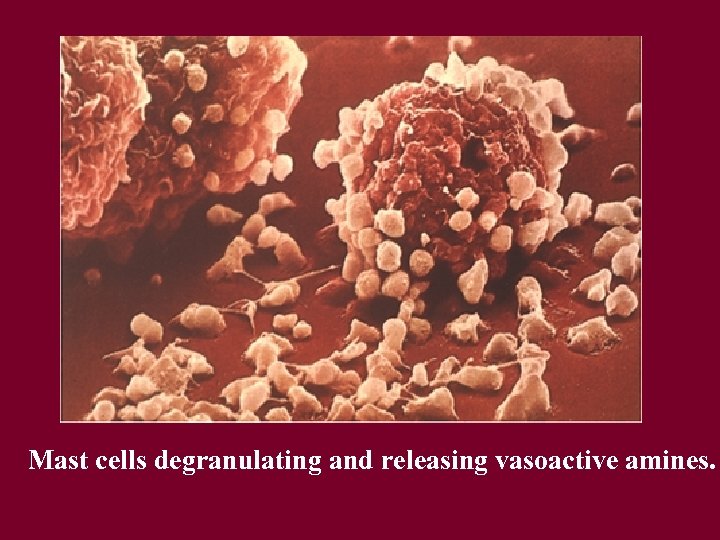 Mast cells degranulating and releasing vasoactive amines. 