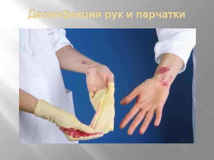Дезинфекция рук и перчатки 